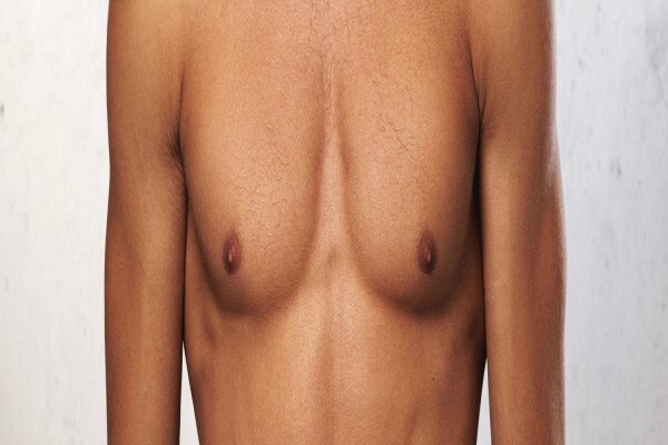 MEDICAL - JOHANNESBURG:Gabriel Doucas
