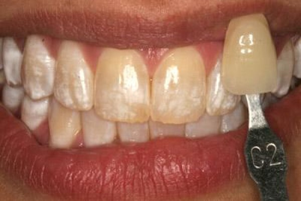 Dr. Bradley Stevan Dentist
