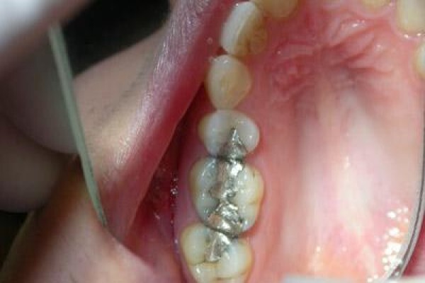Dr. Bradley Stevan Dentist