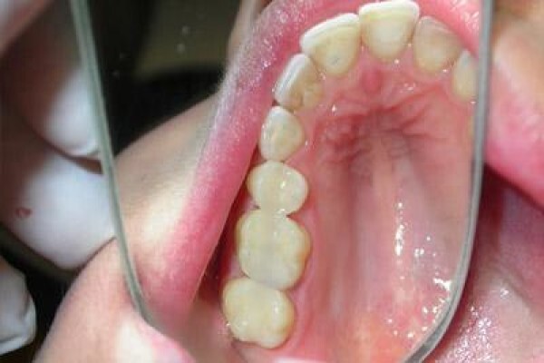 Dr. Bradley Stevan Dentist