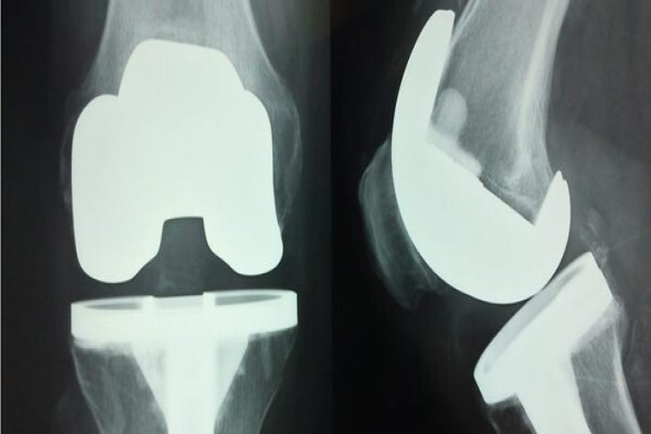 Dr. Richard Von Bormann - Orthopaedic Knee Surgeon