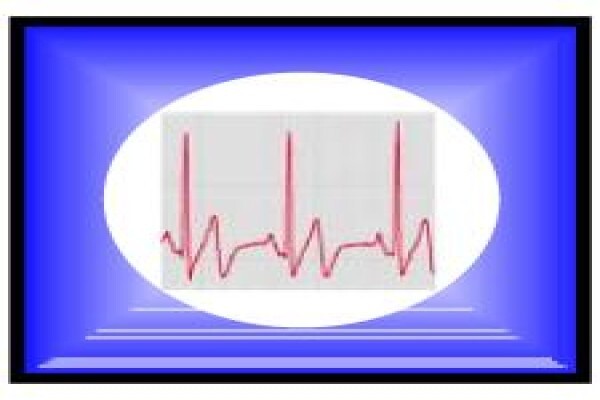 Thermax Electrical Inspections - Kzn