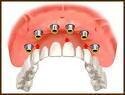 The Specialist Dental Implant Centre (Specialist Prosthodontist) Bchd, Mchd