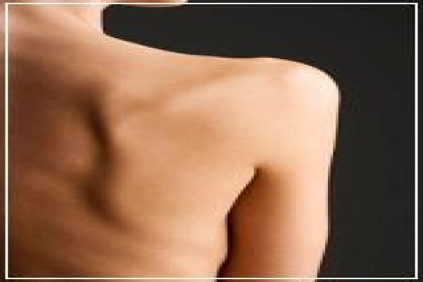 Sonelle Vermeulen Registered Dietician