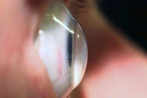 Jacobson Zena Optometrists