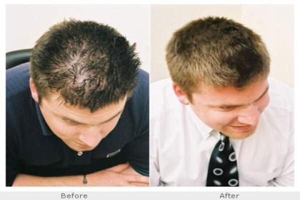 Hair Options