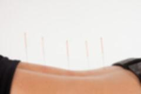 Bell & Rogers Physiotherapist