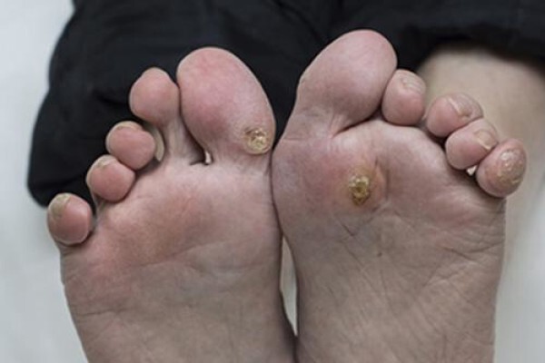 Deepika Patel Podiatrist