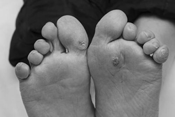 Deepika Patel Podiatrist