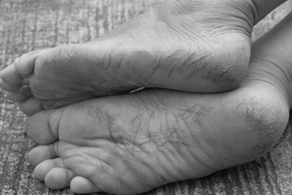 Deepika Patel Podiatrist