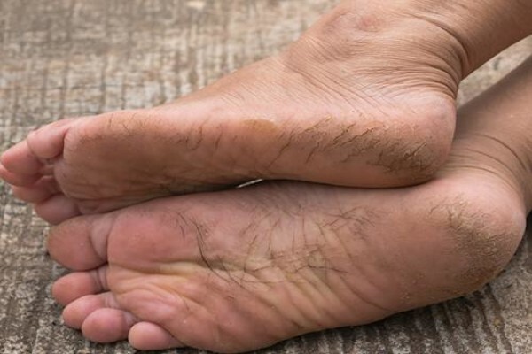 Deepika Patel Podiatrist