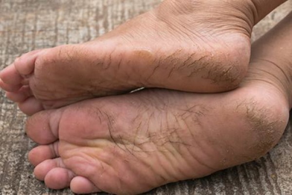 Deepika Patel Podiatrist