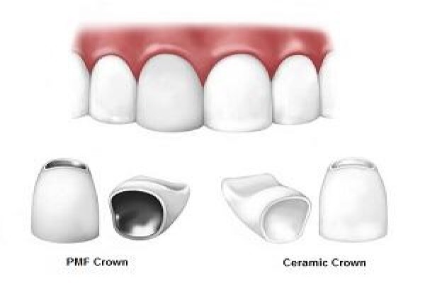 Smith CornÃ© Dr