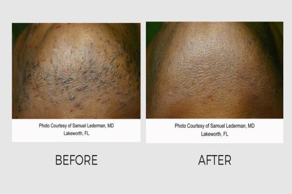 Lasersense Aesthetic Clinic
