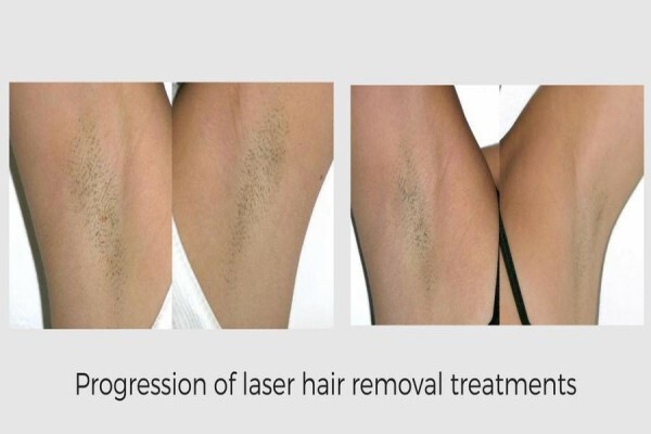 Lasersense Aesthetic Clinic