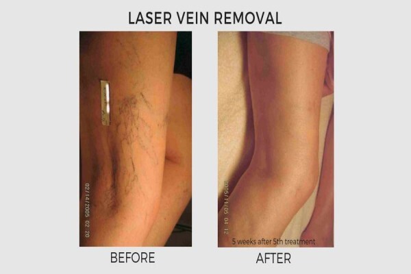 Lasersense Aesthetic Clinic
