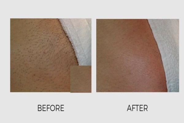 Lasersense Aesthetic Clinic