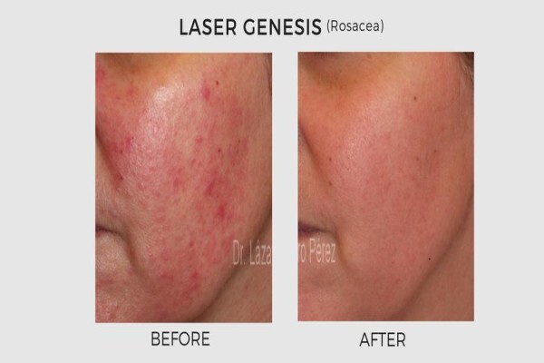 Lasersense Aesthetic Clinic