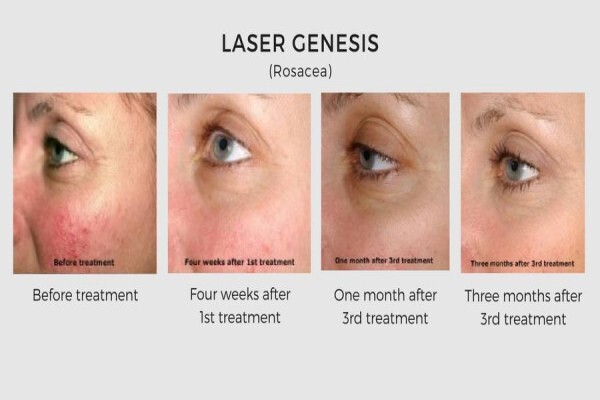 Lasersense Aesthetic Clinic