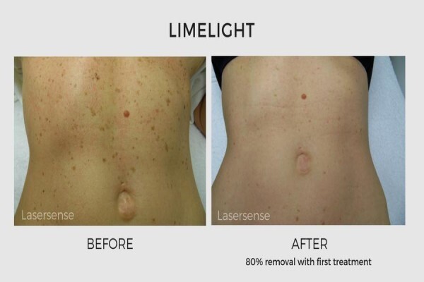 Lasersense Aesthetic Clinic