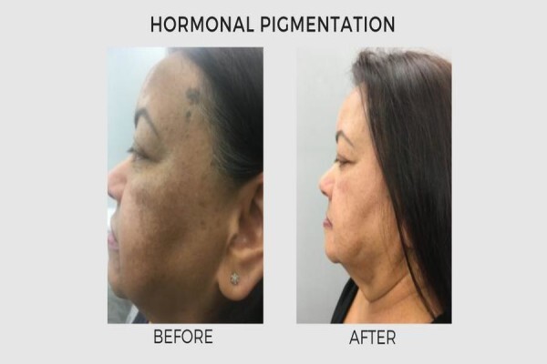 Lasersense Aesthetic Clinic