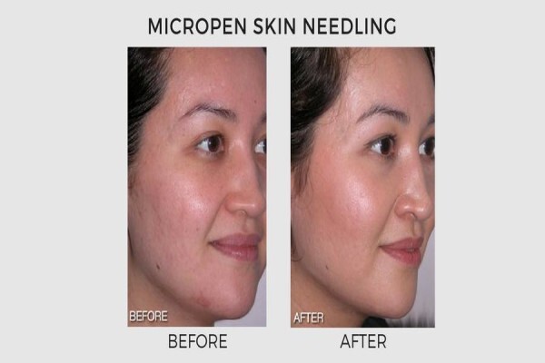 Lasersense Aesthetic Clinic