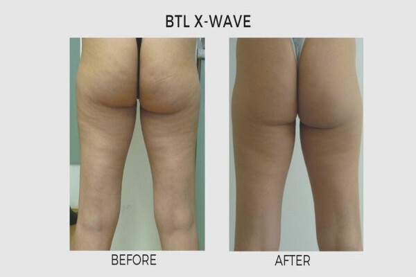 Lasersense Aesthetic Clinic