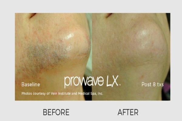 Lasersense Aesthetic Clinic