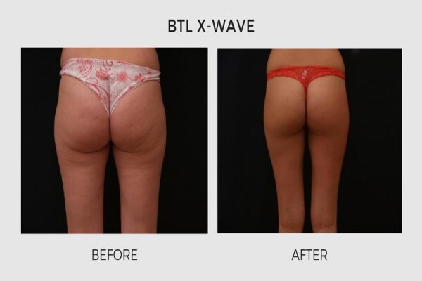 Lasersense Aesthetic Clinic
