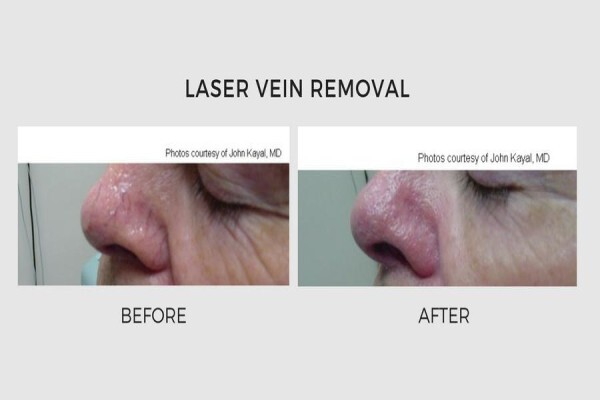 Lasersense Aesthetic Clinic