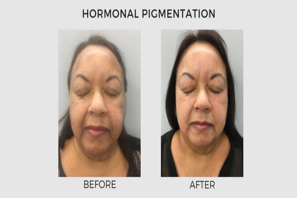 Lasersense Aesthetic Clinic