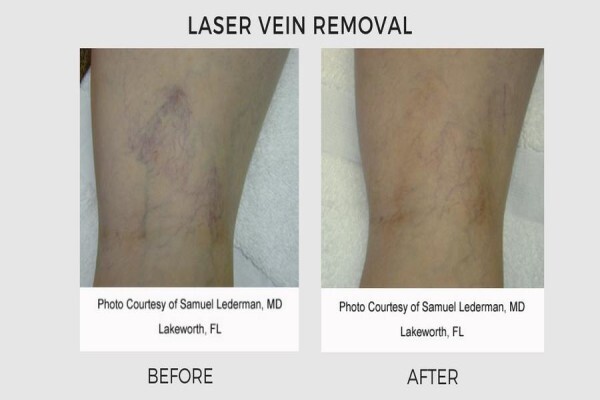 Lasersense Aesthetic Clinic