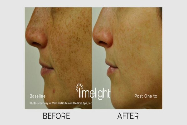 Lasersense Aesthetic Clinic