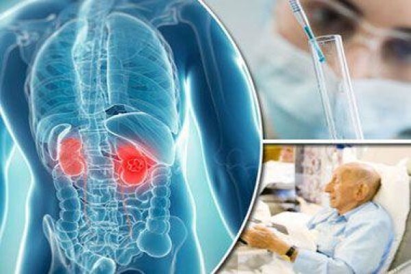 India Cancer Surgery Site