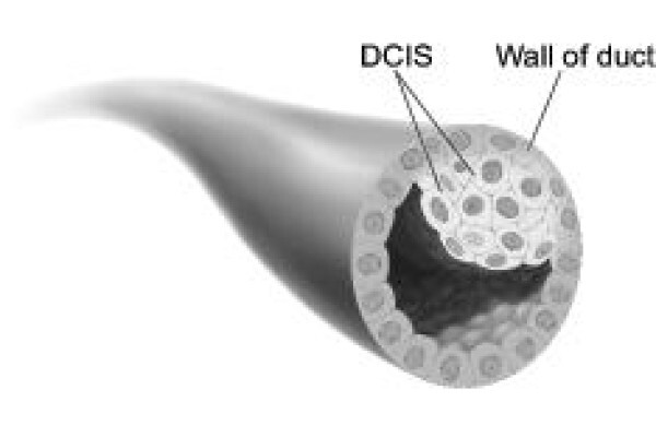 India Cancer Surgery Site