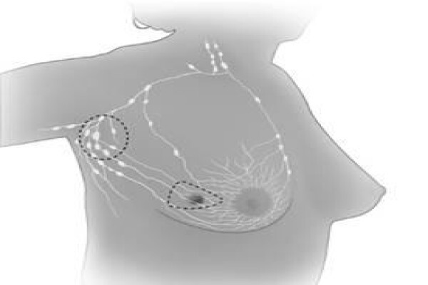 India Cancer Surgery Site
