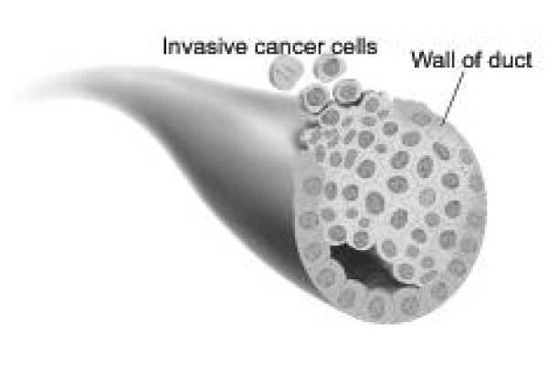 India Cancer Surgery Site