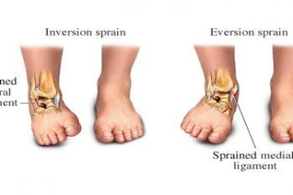 Kerry-Leigh De Boer Physiotherapy