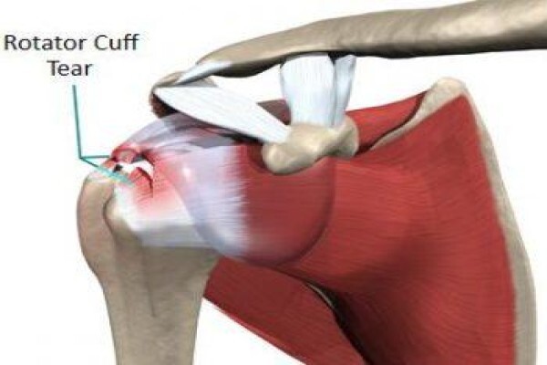 Kerry-Leigh De Boer Physiotherapy