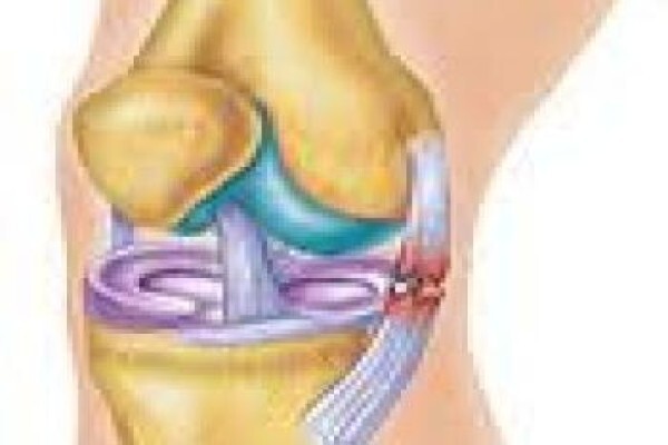 Kerry-Leigh De Boer Physiotherapy