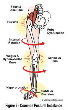 Exercise Therapy