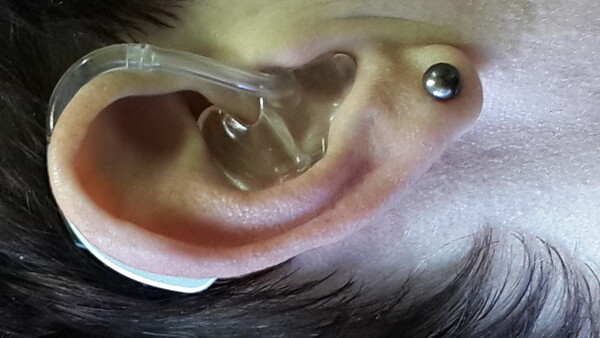 Liesel van der Merwe Audiology
