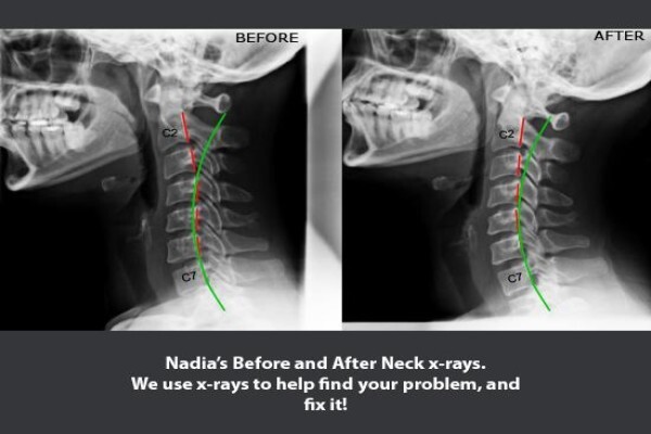 Back to Health Chiropractic