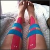 Exercise Therapy