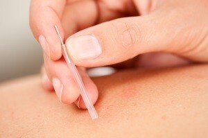 Dr Jacques H Maree Chiropractor