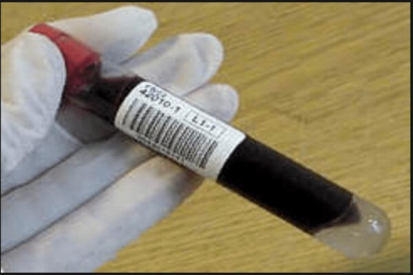 Obesity & Diabetes Management