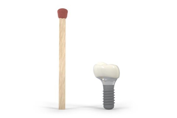 OptiSmile Advanced Optimal Dentistry and Implant Centre