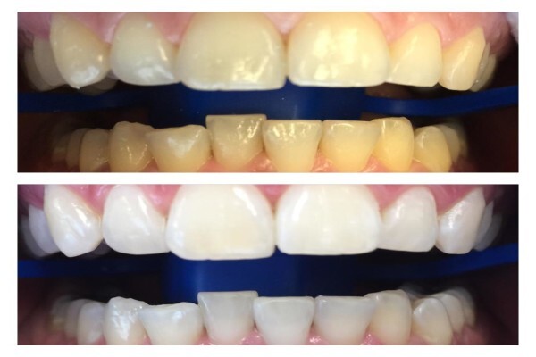 OptiSmile Advanced Optimal Dentistry and Implant Centre