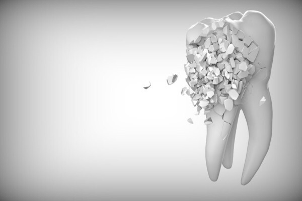 Orthodontist in Pretoria