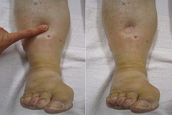 Podiatrist